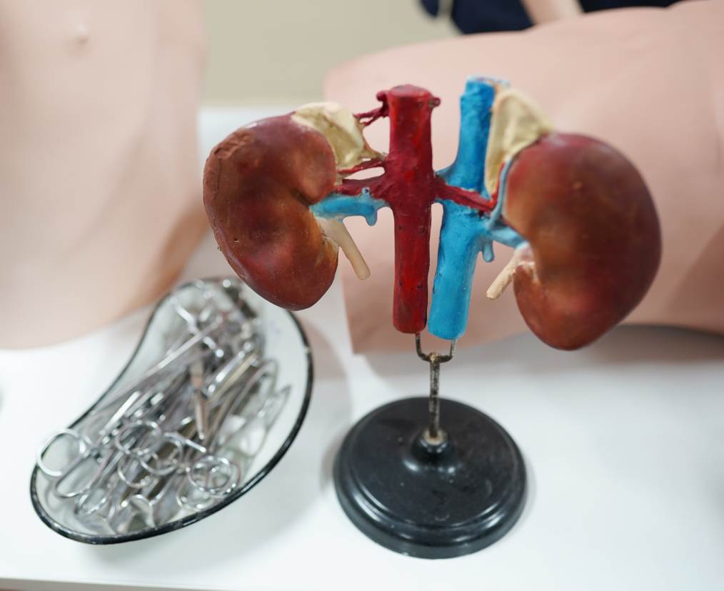 A model of kidneys with surgical tools illustrate the treatment for all urology problems.