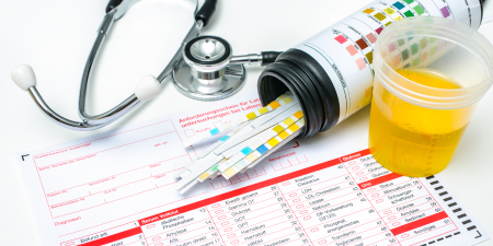A comprehensive urine analysis with sample and reports.